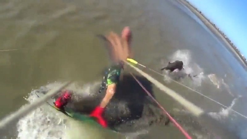 Arjantin'de pitbull uçurtma sörfçüsüne saldırdı