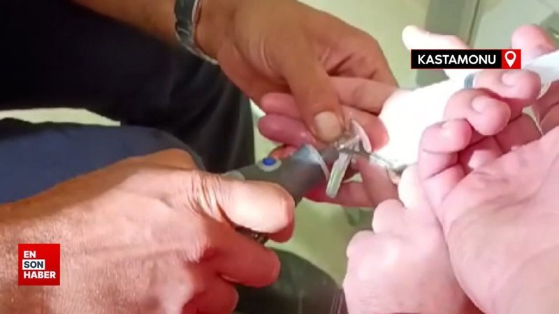 Parmağına sıkışan yüzüğü itfaiye ekipleri çıkardı