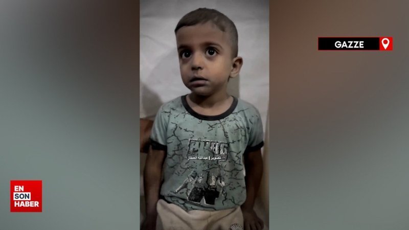 Gazze'deki doktor, korkudan titreyen çocuğu sakinleştirmeye çalışıyor