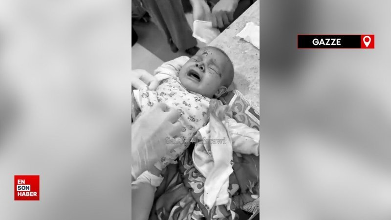 Yaralanan Filistinli çocuklar anestezi olmadan ameliyat ediliyor