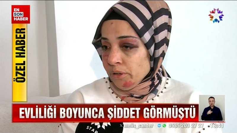 Eski kayınvalidesi ve kayınpederi sokak ortasında dövdü