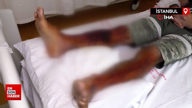 İstanbul'da lavabo açıcı bomba gibi patladı