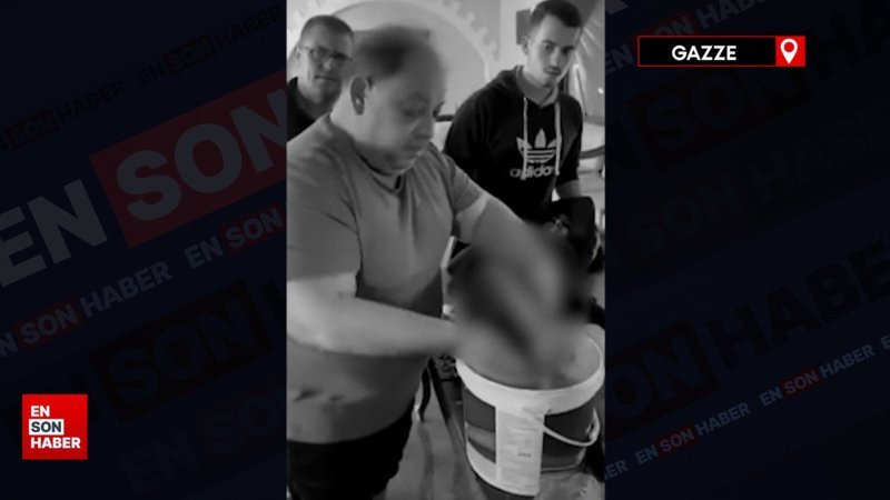 Doktor Hani kuşatma altında tutuldukları evde yeğeninin bacağını ampute etti