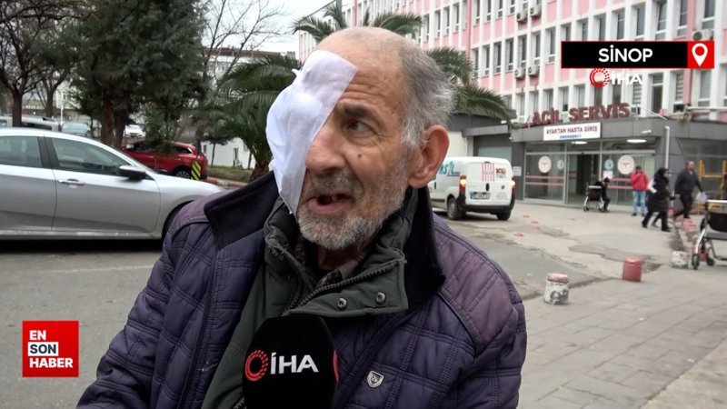 Sinop’ta yüzü eriyen adam tedavi olmak istiyor