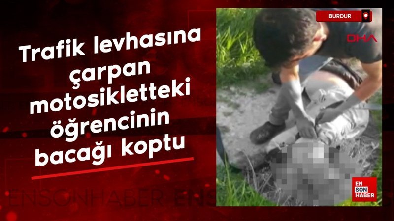 Burdur'da trafik levhasına çarpan motosikletteki öğrencinin bacağı koptu