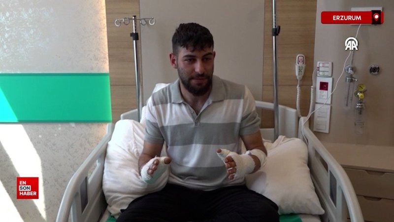 Erzurum'da hararet yapan araca müdahale eden teknisyenin elleri yandı