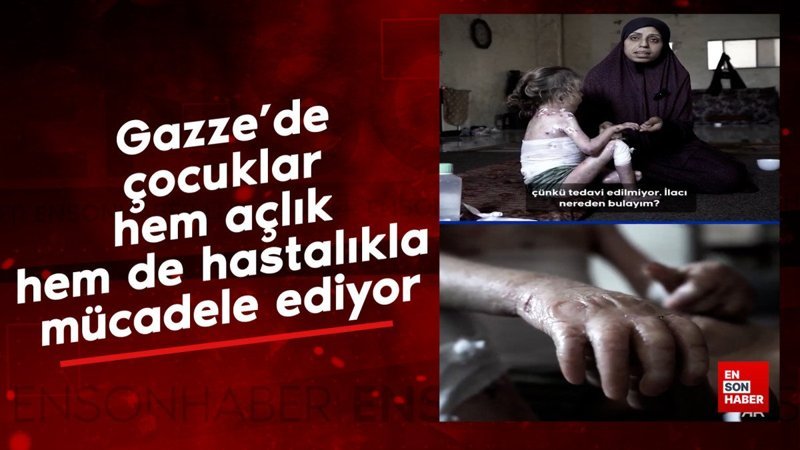 Gazze'de çocuklar hem açlık hem de hastalıkla mücadele ediyor