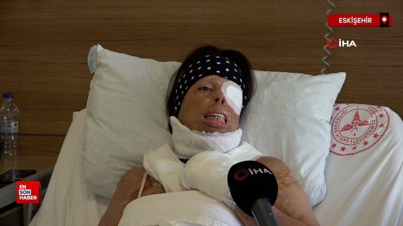 Eskişehir'de genç kadının hayatı karardı