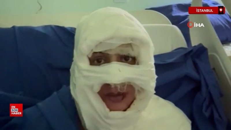 İstanbul Kadıköy'de genç kadın, başka bir kadın tarafından ateşe verildi